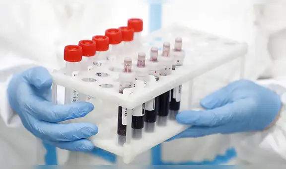 El tipo de sangre estaría relacionado con la gravedad de la infección por COVID-19