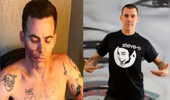 Jackass: Steve-O sufrió la lesión más severa de su carrera y lo comparte en Instagram  [VIDEO]