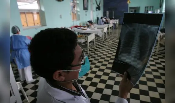 Personas entre 30 y 59 años lideran cifras de infectados por tuberculosis en Lambayeque