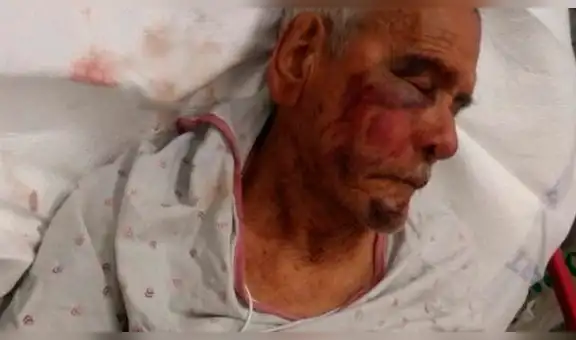 EE.UU.: Anciano de 92 años recibe brutal golpiza por ser mexicano