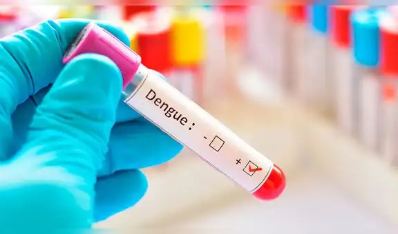 Descubren que el dengue también puede ser transmitido al tener relaciones sin protección