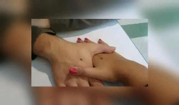 ¿Qué significado tienen los lunares en las manos? Pueden atraer fortuna a tu vida