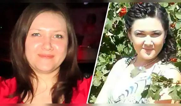 Mujer con el rostro carcomido debido a extraña enfermedad ruega por un diagnóstico [FOTOS] 