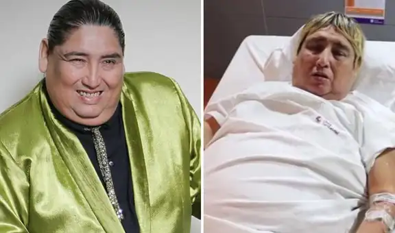 Tongo fuera de peligro y colegas agradecen a Dios: “Es fuerte y desea vivir”