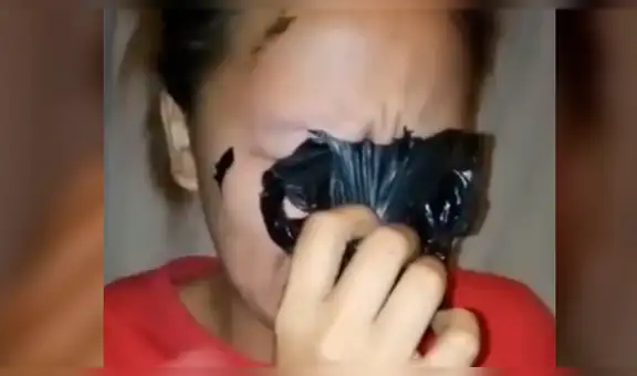 Facebook: muchacha asiática deseaba lucir como estrella K-Pop y se termina 'desfigurando' el rostro