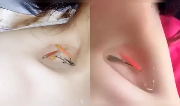 Facebook: el peligroso reto de colocarse peces en la clavícula para probar delgadez [VIDEO]