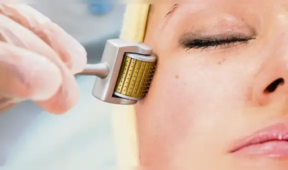 Terapia de inducción de colágeno