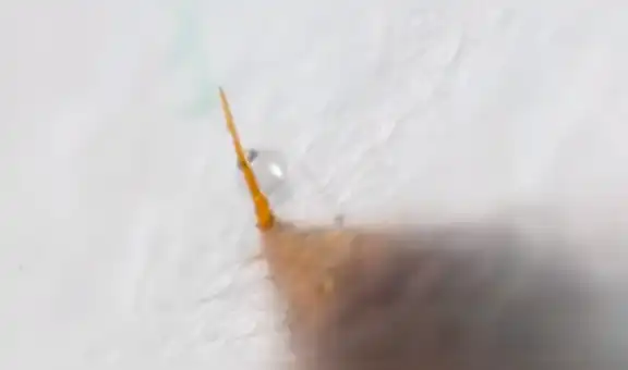 YouTube viral: captan en cámara lenta cómo actúa un aguijón de una hormiga al picar [VIDEO]