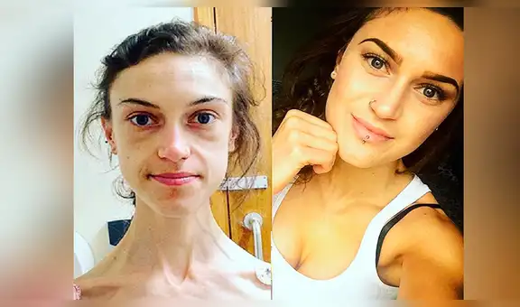En Instagram, joven vence anorexia y su radical cambio sorprende a miles [FOTOS]