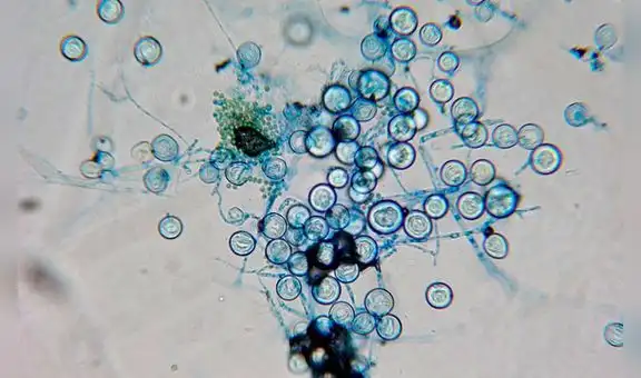 Descubren que los hongos solo tienen sexo si han comido y están a oscuras