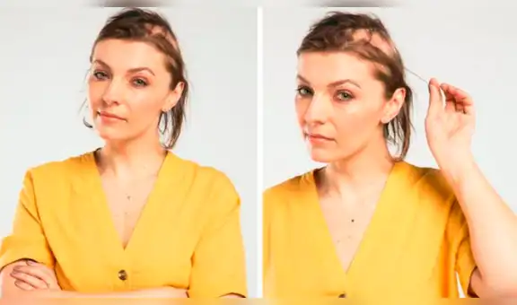 Facebook viral: novia pierde el 90 % de su cabello por el estrés de su boda y así termina [FOTOS] 