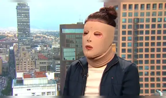 Saxofonista atacada con ácido aún teme por su vida y la de su familia [VIDEO]