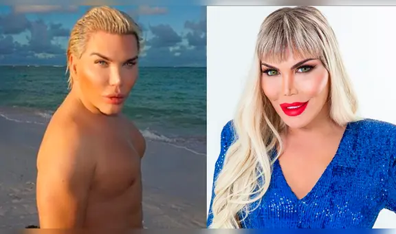 ‘Ken humano’ revela cómo lucía antes de operarse más de 70 veces y sorprende a sus fans [VIDEO]