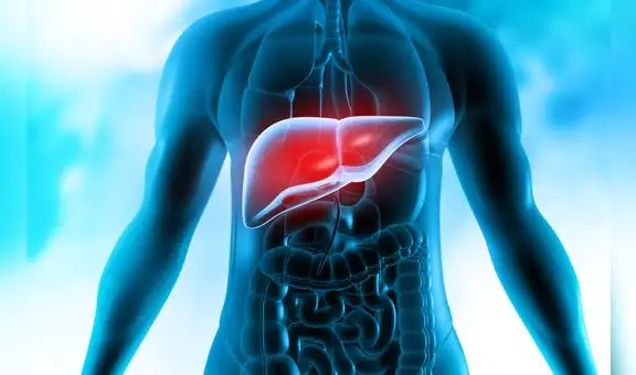 ¿Qué es la cirrosis hepática? Síntomas y prevención