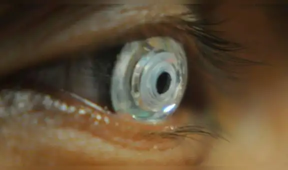 Científicos crean lentes de contacto que hace ‘zoom’ con solo parpadear [FOTOS]
