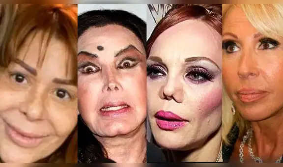 Alejandra Guzmán y otras estrellas que deformaron su rostro por abuso de cirugías