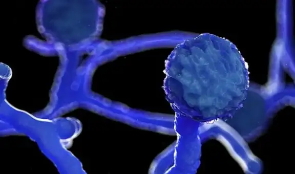 ‘Hongo negro’, la infección mortal que mutila a pacientes COVID-19 en India