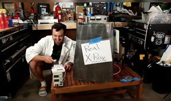 Hombre construye su propio rayos x luego de que le cobraran  $ 70.000 en el hospital