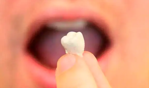 ¿Qué significa soñar que se te caen los dientes?, ¿será un mal presagio?