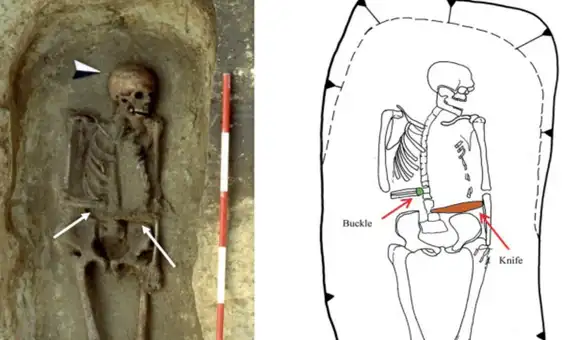 El extraño hombre medieval que reemplazó su brazo amputado con un cuchillo