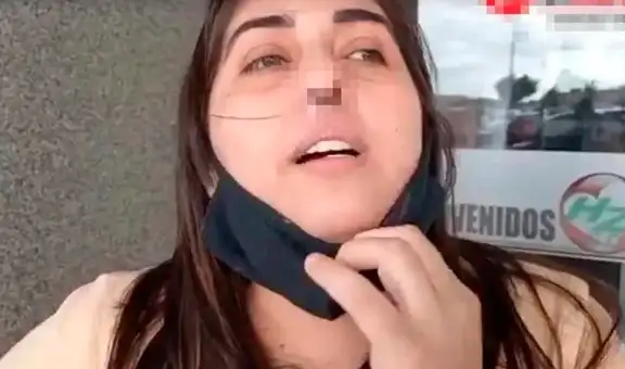 La hisoparon mal y perdió el cartílago de la nariz: el drama de una enfermera en Argentina