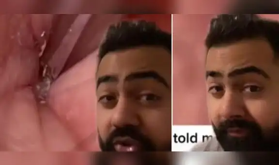 Médico explica qué puede suceder si una persona no se lava correctamente el ombligo y se vuelve viral