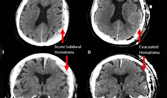 Confirman que la vida puede ‘pasar ante los ojos’ cuando estamos por morir