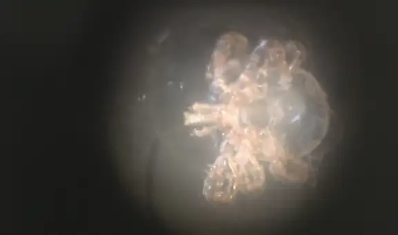 Una agresiva garrapata puede causar alergia a la carne roja tras picarte