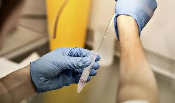 Detectan ADN de la viruela del mono en semen humano: la OMS inicia investigación