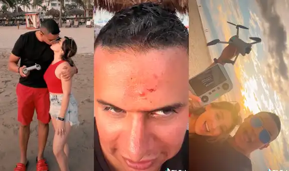 Joven trata de grabar un video romántico con su novia, pero dron se estrella en su frente