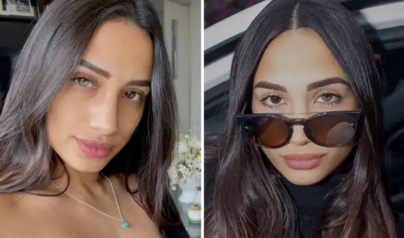 Valery Revello: ¿qué condición tiene en sus ojos y por qué uno es de color verde y el otro marrón?