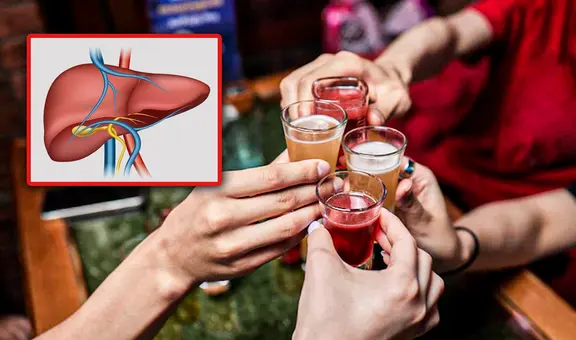 ¿Cómo desintoxicar mi hígado tras consumir alcohol en exceso?