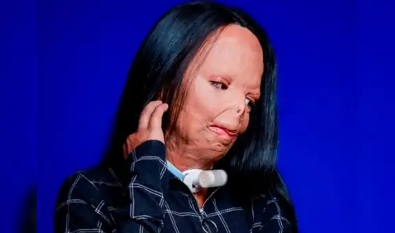 ¿Quién es Aleema Ali, la joven víctima de quemaduras que triunfa entre las expertas en maquillaje?