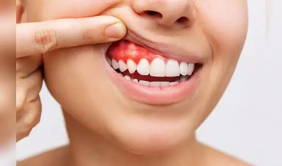 Salud bucal: periodontitis y enfermedades sistémicas