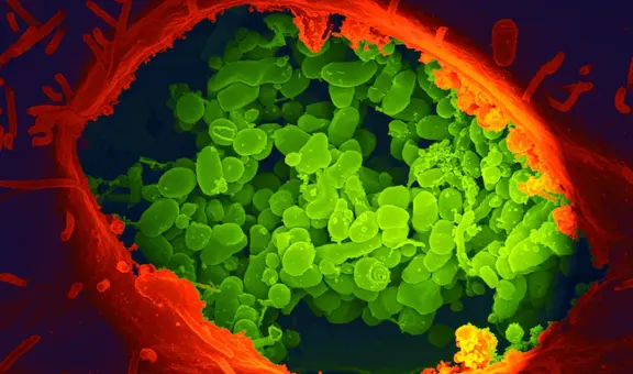 La sustancia más mortal del mundo: 1 gramo podría matar hasta a 100 millones de personas