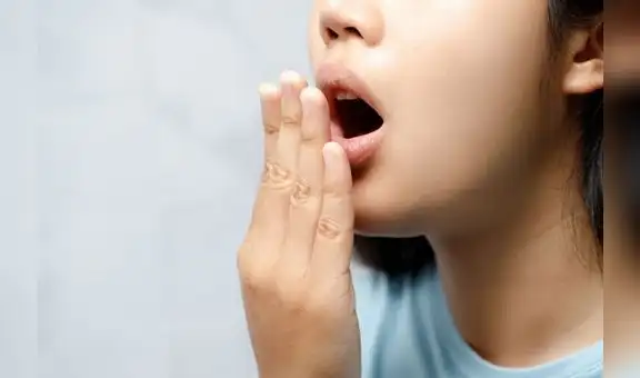 Salud bucal: halitosis y cuidados para evitarla