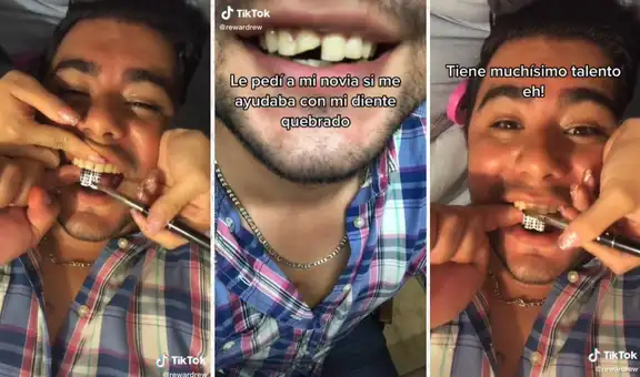 Se le quiebra el diente y su novia manicurista sorprende con su innovadora solución
