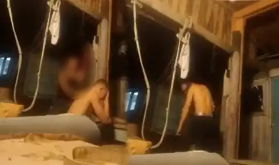 Joven ruso decide romperse un brazo para no ser reclutado en la guerra contra Ucrania
