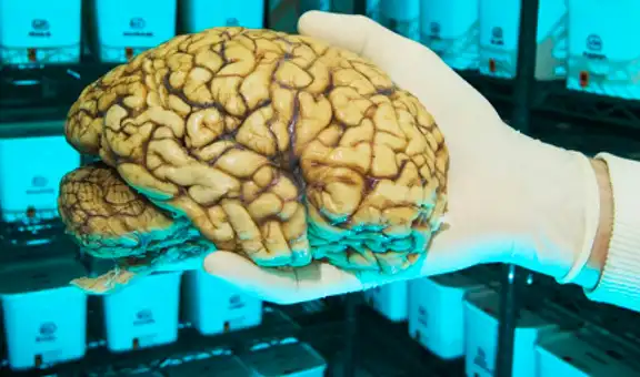 ¿Qué se descubrió al realizar estudios a los cerebros de asesinos famosos?