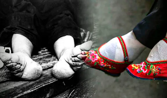 Pie de loto: ¿por qué las mujeres en China se vendaban los pies para deformarlos?
