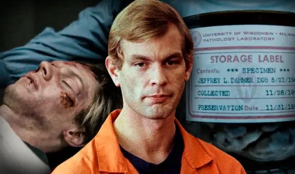Jeffrey Dahmer, autopsia [FOTOS]: ¿qué pasó con su cerebro tras la muerte del caníbal?