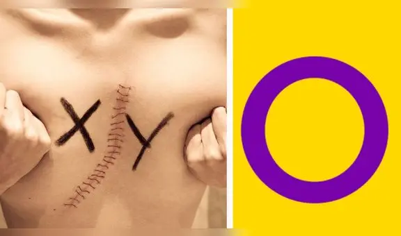 Día de la Conciencia para la Comunidad Intersexual: ¿por qué se celebra este 26 de octubre y cuál es su importancia?
