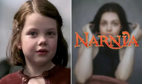 Actriz de “Las crónicas de Narnia” casi muere por bacteria come carne y expone sus secuelas