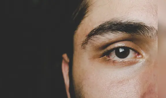 ¿Por qué late mi ojo y cuán peligroso es para mi salud?