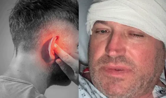 Pensó que sufría una infección de oído, pero tenía un tumor y le queda poco tiempo de vida