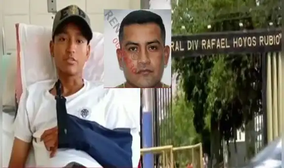 Madre denuncia que suboficial del Ejército le rompió el brazo a su hijo militar en el cuartel