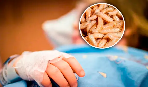 Niña de 4 años fue llevada al hospital y le extrajeron más de 100 gusanos de su cabeza