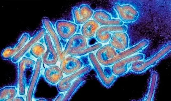 Guinea Ecuatorial declara alerta sanitaria tras confirmar 9 fallecidos por el virus de Marburgo