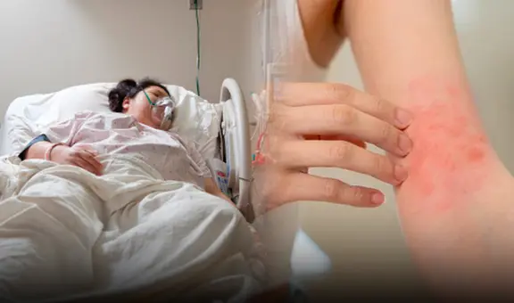 Niña de 13 años fue al hospital por fuertes dolores de cabeza y murió horas después