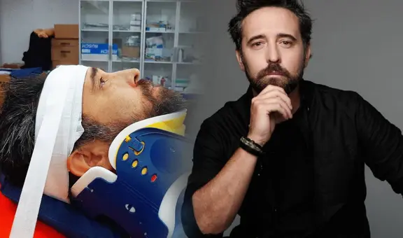 ¿Diego Dibós sufrió accidente? Cantante sube foto en camilla a redes sociales y alerta a fans